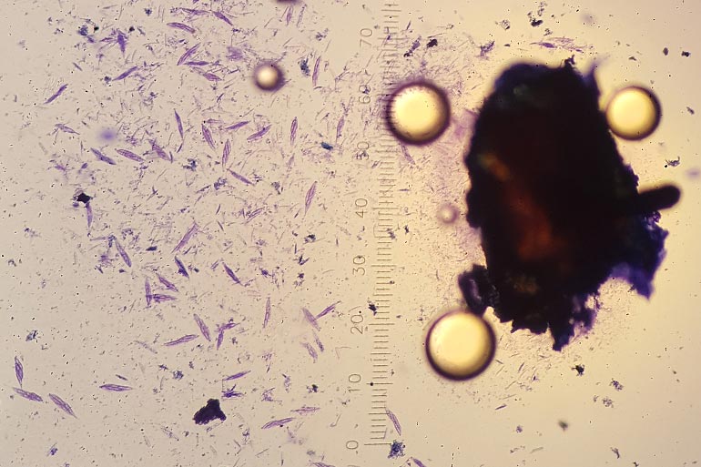 Anthracnose