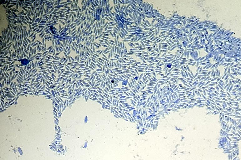Colletotrichum